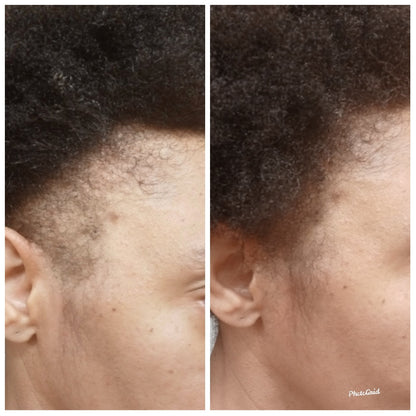 Infinity Hair Growth Oil